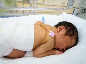 早産・低体重児との関連