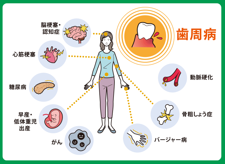 歯周病（歯槽膿漏）の治療・予防 | 川越歯科クリニック